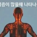 몸에 염증이 많을때 나타나는 증상 이미지