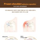 365강추한의원 이미지