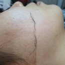 보니샵 | [부산-사하]보니샵후기,스킨플래닝후기