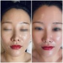 다이소사천평화점 | [사천 디바스킨] 예비 신부 입소문 찐후기! 멍 걱정 없는 웨딩관리 '디데이 케어'