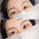 오느른, 속눈썹