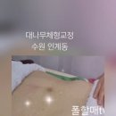 대나무체형교정 이미지
