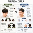 부분가발? 전체가발? 무얼 선택해야 하나요 | 부천 가발 상담