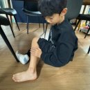 스타트메디칼 | 화상치료/상처치료 유고스타트 창상피복재 메디폼 드레싱