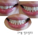 윤이나클린