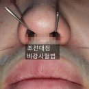 공명한의원 | 자율신경실조증 약주사로 치료의 한계가 나타나면 ? 원인치료법(광교도침한의원)