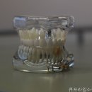 큐프라임소풍치과의원 네이버블로그