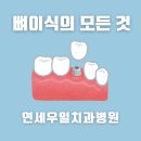 연세우일치과병원 | 천안 뼈이식의 모든 것 연세우일치과병원