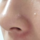 에스씨정보 | [여드름크림 더마에스씨 센텔라시카크림 후기] 붉은기·홍조 진정까지 확실했던 시카크림