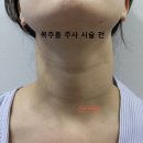 유올림의원 네이버블로그