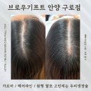 안양-안양-안양-515 | 가르마 정수리 두피 고민 안양 브로우기프트 방문했어요