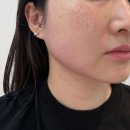 대백프라자 앞 교통섬 | 세르프리프팅 후기｜처진 턱라인 리프팅 레이저 추천, 대구세르프 솔직후기