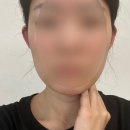얼굴작아지는법 꿀팁 공유 - 지안제이 이어비 누운귀테이프로 귀셀프교정