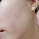 주앤랩 센텔라 리바이탈 재생크림 으로 민감한 건성피부 케어