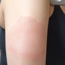 코로나백신 접종 / 코로나백신 해외접종자는 국내 적용 어떻게 되나요?