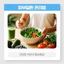 평촌자생한의원 | 안양습진치료 진물과 가려움이 계속된다면
