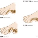 청담탑정형외과의원 이미지
