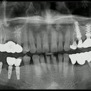내곡웰치과의원 이미지