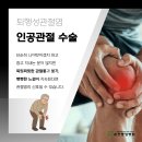 순천중앙병원 | 순천인공관절 퇴행성관절염 통증이 반복될 때