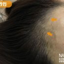 향헤어라인