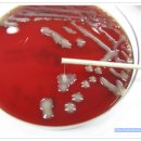 String 현상(BAP Klebsiella pneumoniae ssp pneumoniae)의 모습 이미지