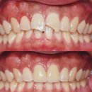 신영치과기공소 이미지