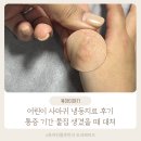 구슬약국 | 어린이 사마귀 냉동치료 후기 통증 기간 물집 생겼을 때