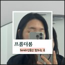 더자 | 구미헤어라인문신 | 프롬더봄 수술 없이 M자 이마 탈출 헤어라인교정 솔직후기