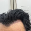 뷰티헤어라인 이미지