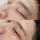 유아이미