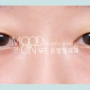 무드온성형외과의원 이미지