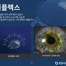 밝은눈안과병원 이미지