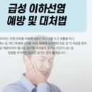 볼거리 증상 전염 볼거리 원인 치료 이미지