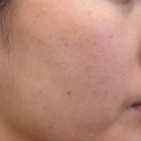 계피부과 : 서울 영등포 피부질환 진료 보는 피부염 모낭염 피부과 전문의 병원 방문 후기