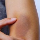 양이멍이 이미지