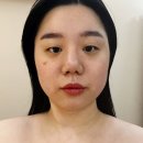 이마상사 김포지점 | 구래피부관리 추천│이연에스테틱 올리지업 2000샷 후 느낀 리프팅 효과