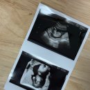 느낌좋은산부인과의원 이미지