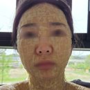 연세보드미의원 네이버블로그