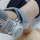 비앤피 | 비앤피발가락교정기 무지외반증 교정기 비앤피메디컬 착용 후기