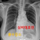 소문난내과의원 네이버블로그