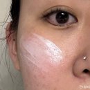 보람메디컬 이미지