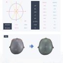 비바윤 | 아기 두상교정 헬멧 1년 착용 리얼후기 (비바헬멧 가산점)
