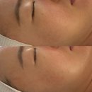 권뷰티 - 강동구 천호대로 1077 | 일산 피부관리 추천 일산리프팅관리 권뷰티 후기