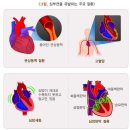 2대 심장질환 분류표[별표-질병관련16] 이미지