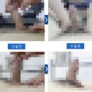 케이신경과의원 | 남성수술잘하는곳? 성공적인 수술은 '이것'으로 완성됩니다