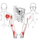 통증해소와 자세교정을 위한 볼테라피 (주1회 4주 클래스) 이미지