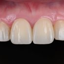 엠웍스 치과기공소 이미지