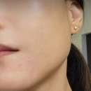 나음약국 | 콜라겐크림 다이소 vs 약국 효능 탄력마사지 비교후기ㅣ전후사진