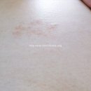 모닝안경원 | 나, 나아지고 있는걸까?