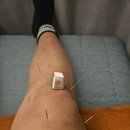 청주나비솔한방병원 | 교통사고 입원 후기 – 나비솔한방병원에서 3박 2일 입원하고 온 소감 🏥